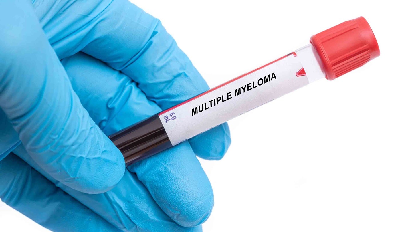 ARUP introduces spectral flow assay for multiple myeloma
