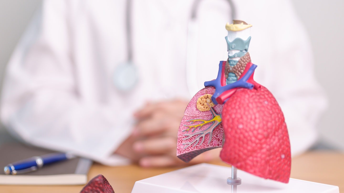 bioAffinity and Pictor partner on diagnostics for asthma and COPD