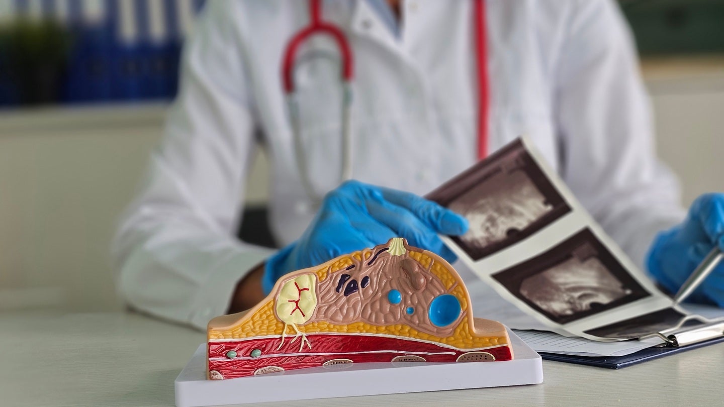 FDA grants 510K clearance for DeepHealth’s AI breast ultrasound technology