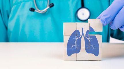 The biggest opportunity to improve lung cancer survival isn’t a new drug