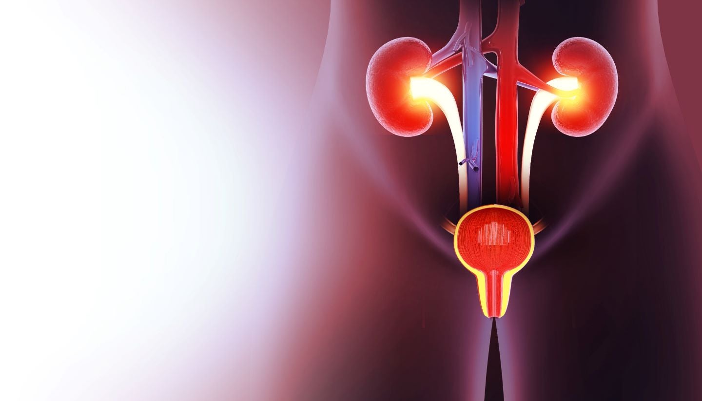 Olympus-backed MaxQ Medical raises $31.5m for prostate care platform’s advancement