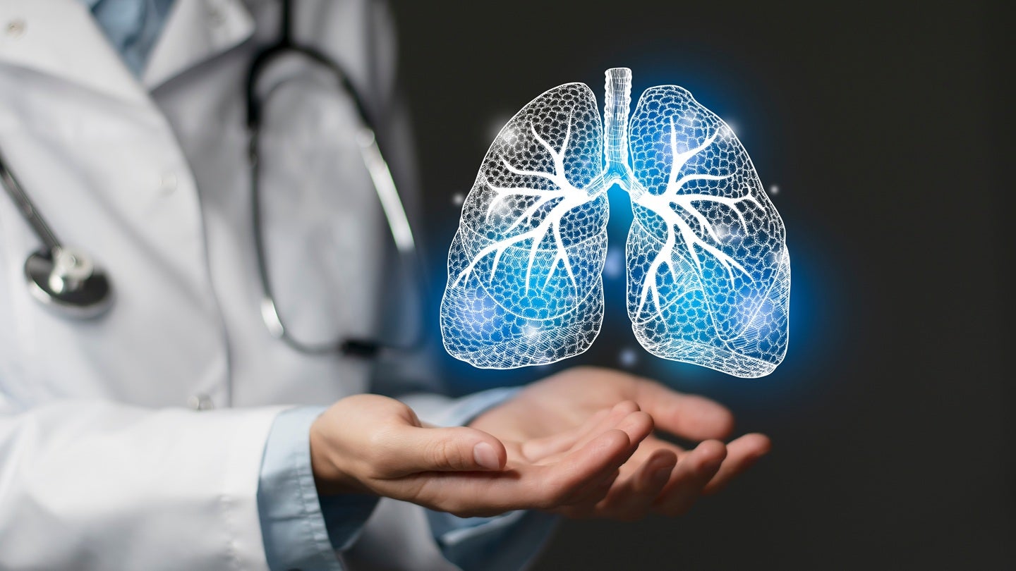Evinova and Lothar Medical partner on respiratory device trials
