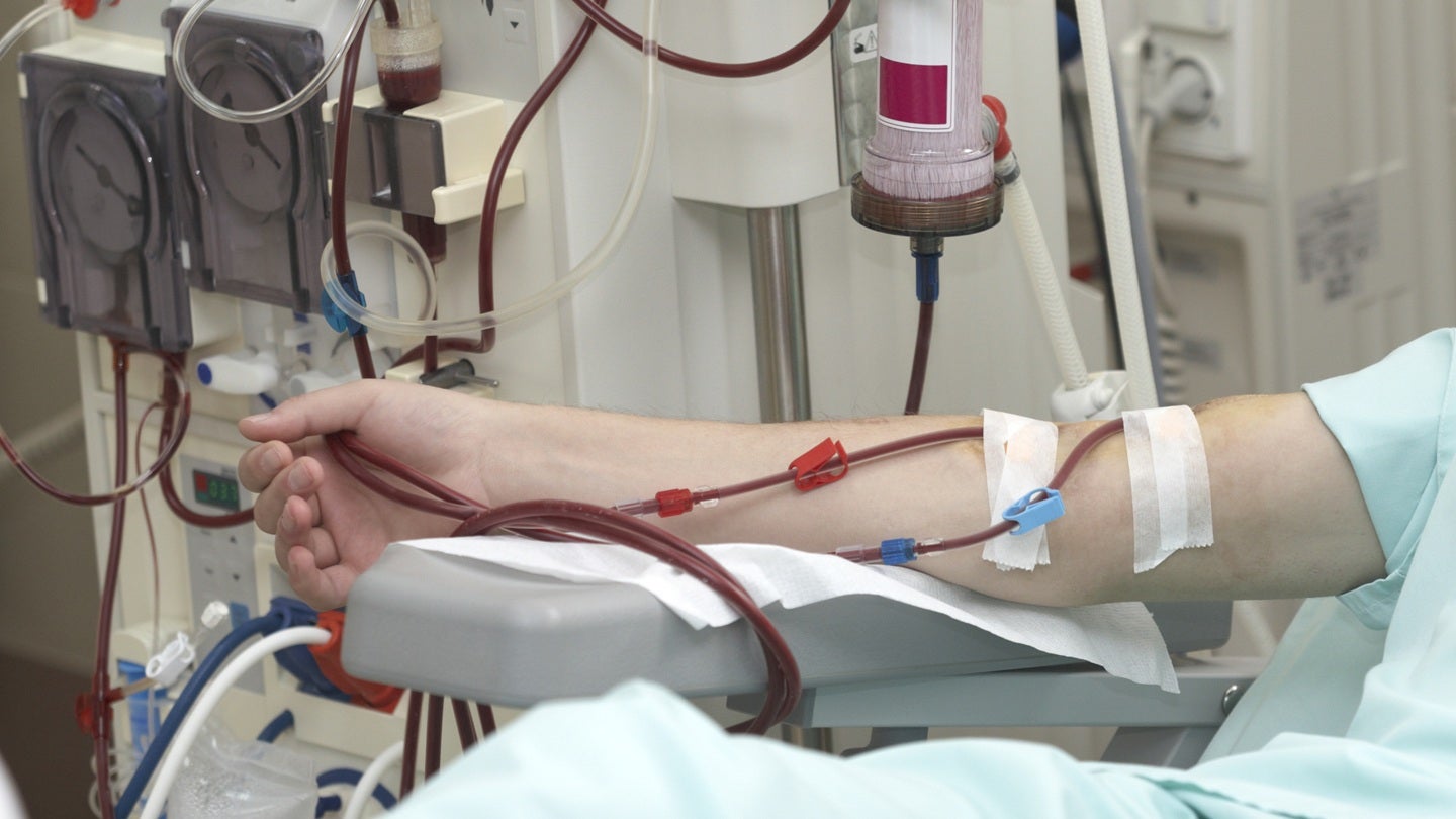 Dialybrid raises $17m to advance Silkothane device