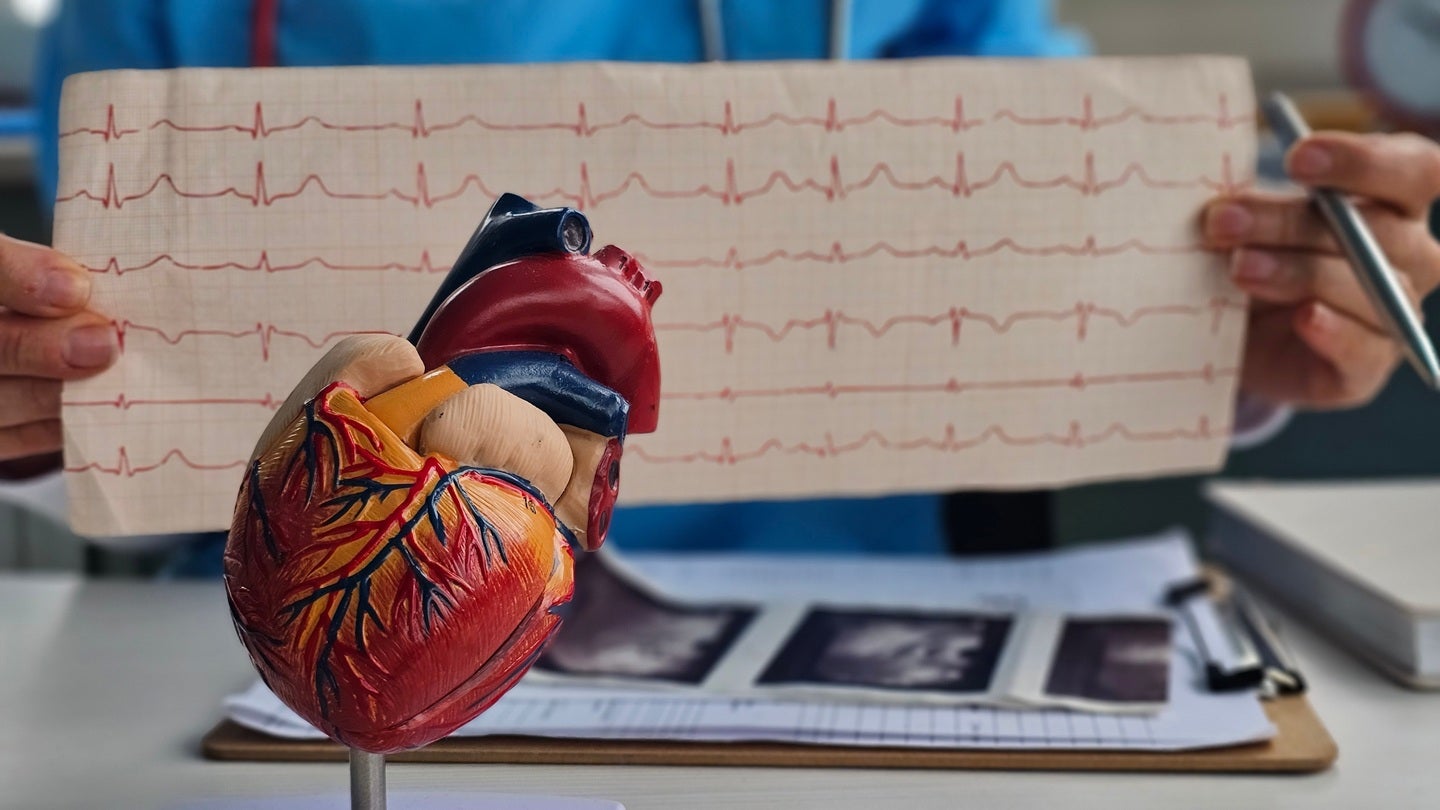 CardiaCare secures seed extension funding for AFib clinical studies
