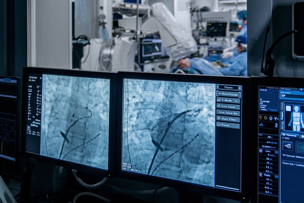 Protected: Monitoring devices for preventative care in cardiovascular patients