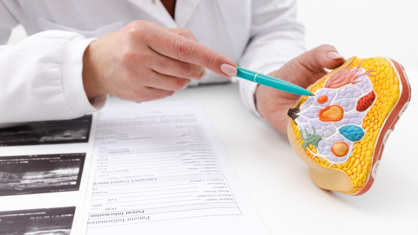 IceCure enrols initial patients for ProSense cryoablation trial in US