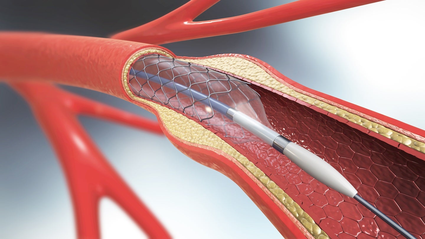 FDA grants breakthrough device status to Teleflex’s coronary scaffold