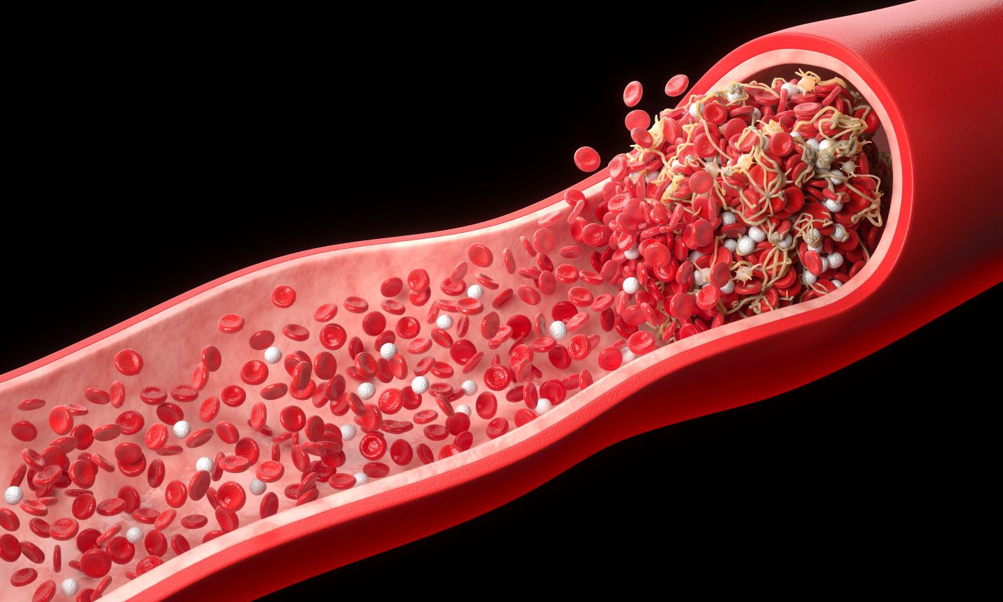 Abram snags $8.3M US DoD contract to advance blood coagulation diagnostic